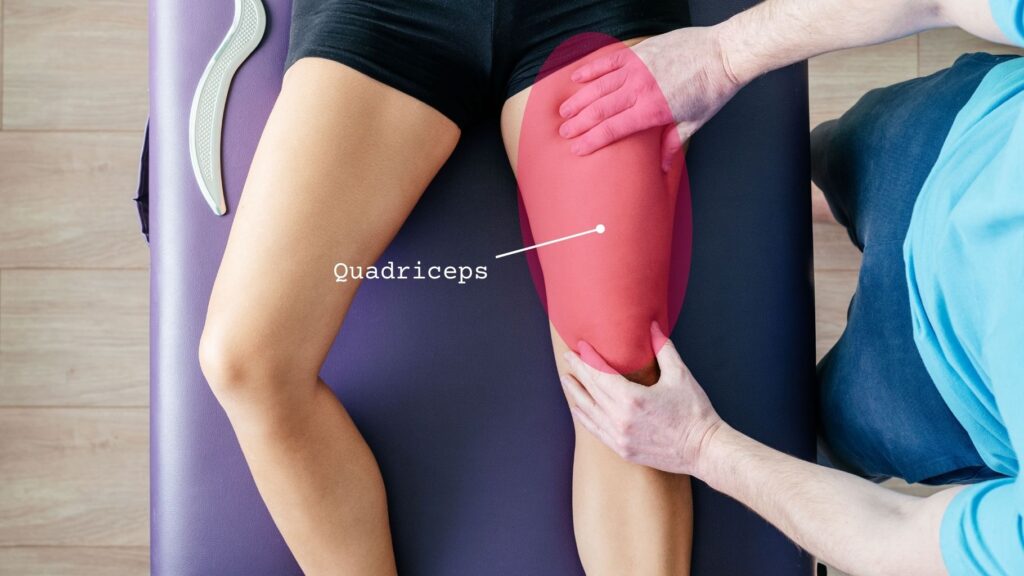 Afbeelding van de quadriceps femoris met de vastus lateralis, vastus medialis en rectus femoris aangegeven. De vastus intermedius ligt onder de rectus femoris.