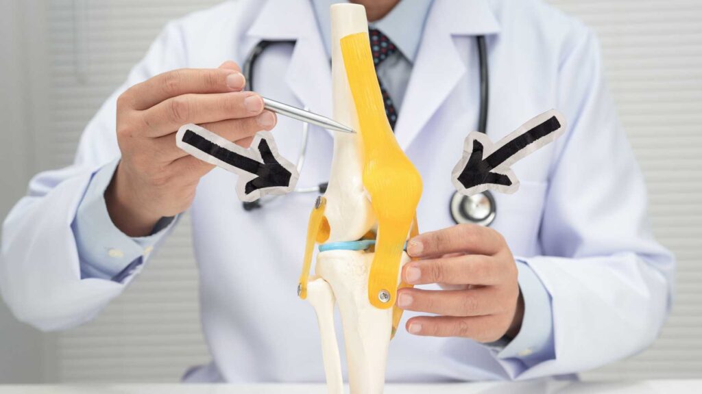 Knieprothese is niet altijd nodig, probeer eerst met oefeningen je pijn en stijfheid te laten dalen.